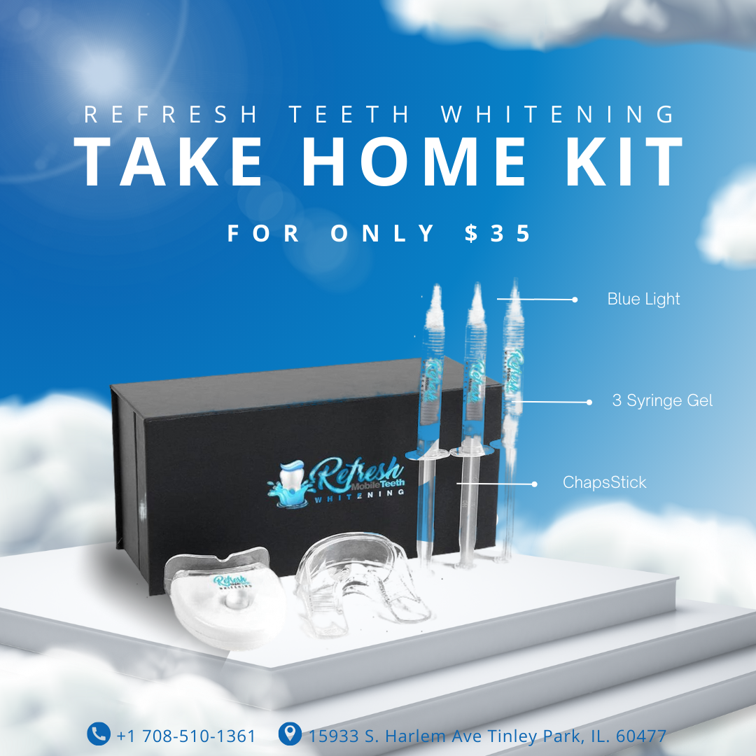 Refresh Teeth Whitening Take-Home Kit